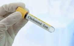 testna epruveta za kolesterol
