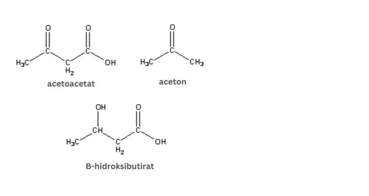 Ketonska tijela Kemijski prikaz ketonskih tijela acetoacetata, acetona i B-hidroksibutirata