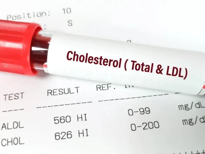 Naslovna slika za clanak Kako smanjiti kolesterol u 3 koraka