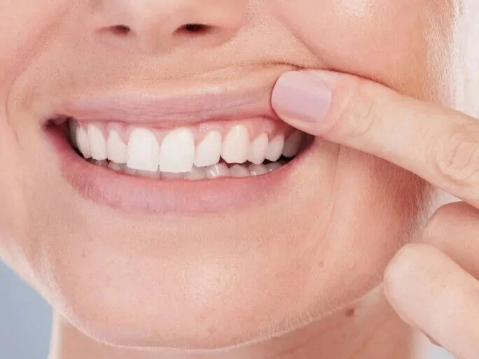 Naslovna slika za clanak Kako vitamini mogu osnažiti zubno meso i očuvati njegovo zdravlje?