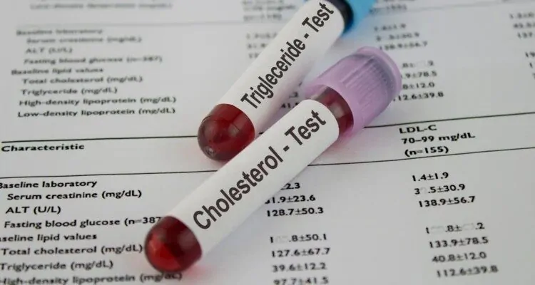 Test kolesterola